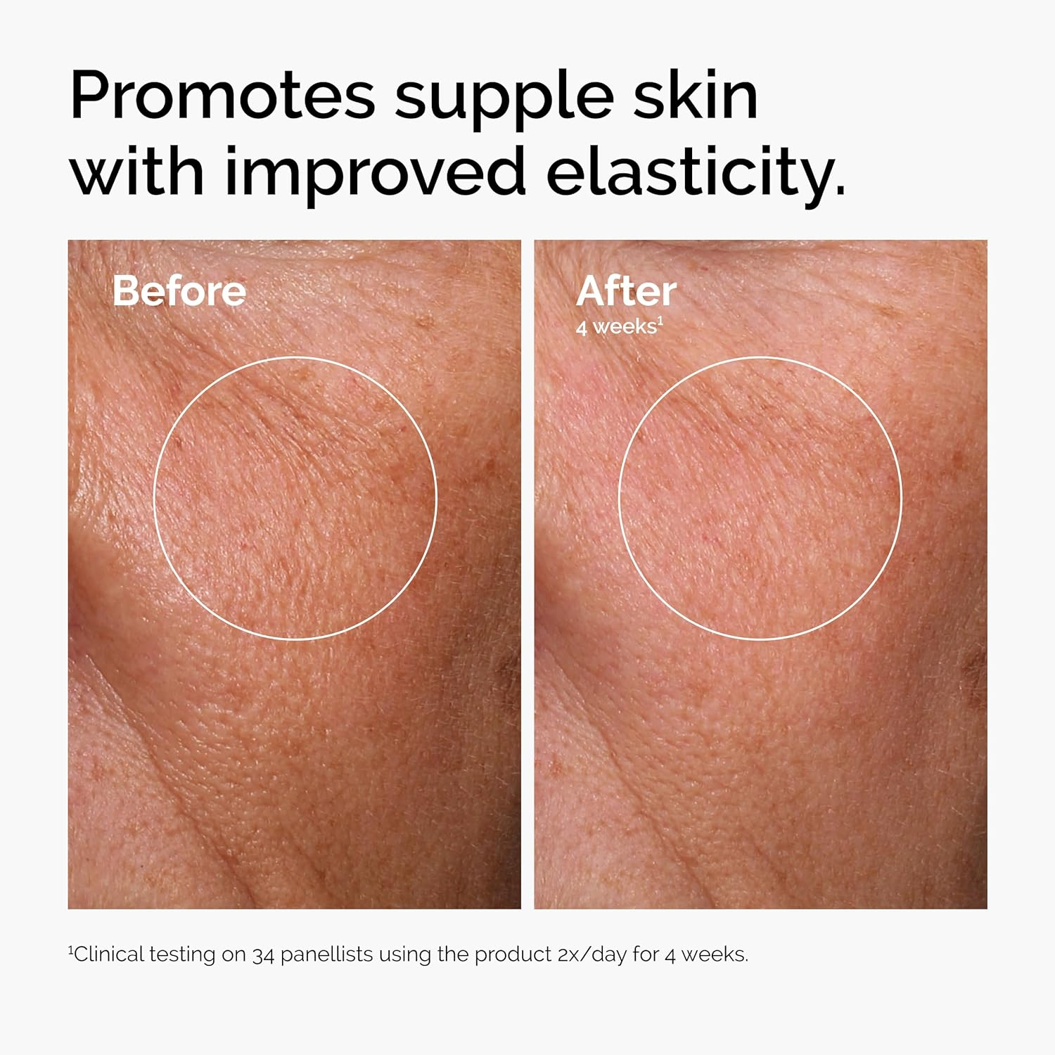 سرم آبرسان پوست هیالورونیک اسید 2% سرم B5 اوردینری (MK) (ضمانت اورجینال) Hyaluronic Acid 2% + B5 - Image 2