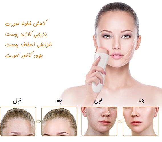 مینی هایفو مدل سه کاره MINI HIFU - تصویر 3